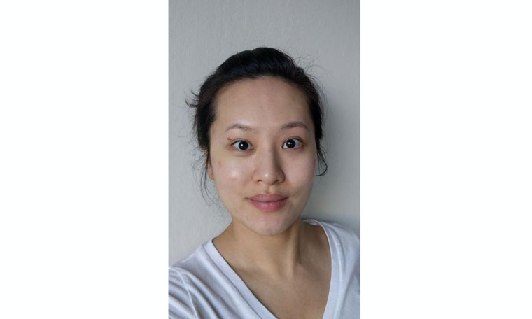 korean-beauty-products-for-contact-dermatitis
