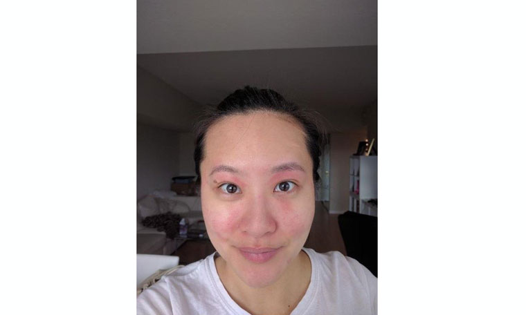 korean-beauty-products-for-contact-dermatitis
